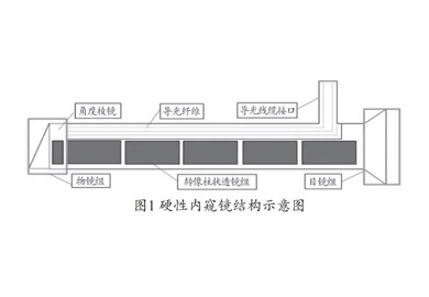 Rigid Endoscopy Structure and Working Principle