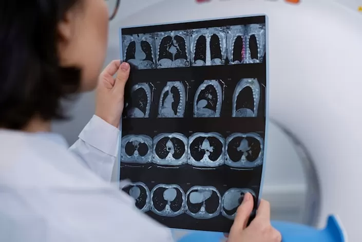 The Characteristics of Polygonal Scanning Mirror and Its Market Prospect Forecast
