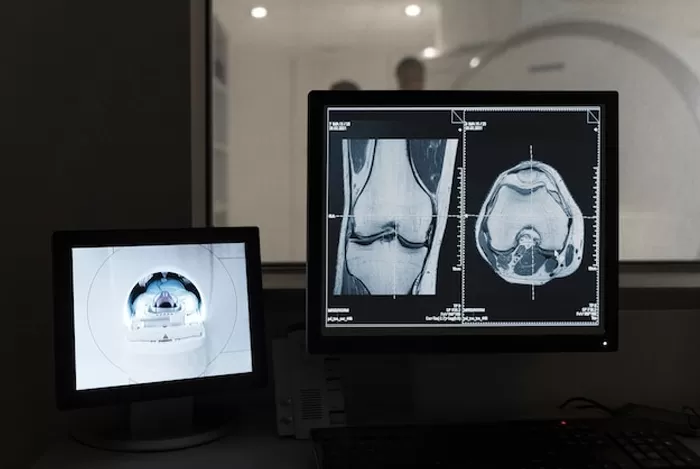The Characteristics of Polygonal Scanning Mirror and Its Market Prospect Forecast